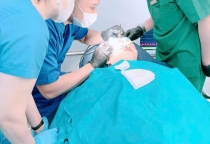 Nâng cơ trẻ hóa 